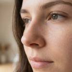 pores dilatés comment les réduire naturellement