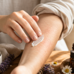 Comment soigner ton eczéma naturellement quand le stress le déclenche ?
